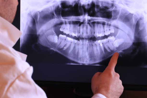 Best Walk-In Emergency Dental Services in Mitchell, SD