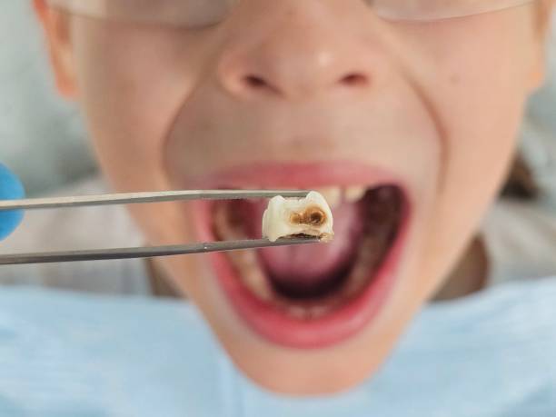 Best Emergency Cosmetic Dentistry (e.g., broken veneers) in Mitchell, SD